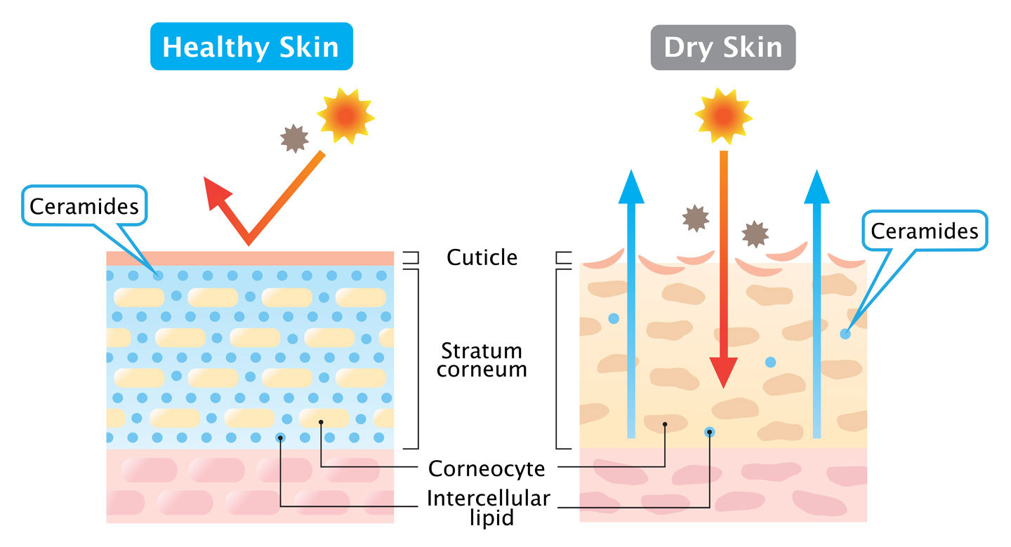 Ceramides and Dry vs. Healthy Skin